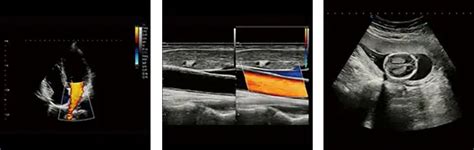 Zobrazenie ultrazvukového prístroja