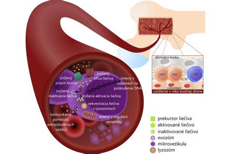 Grafické znázornenie hormonálneho telieska Mirena