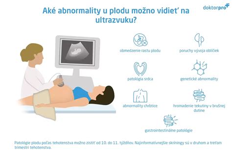 Schéma morfologického ultrazvuku plodu
