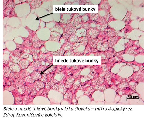 Schema pôsobenia ultrazvuku na tukové bunky