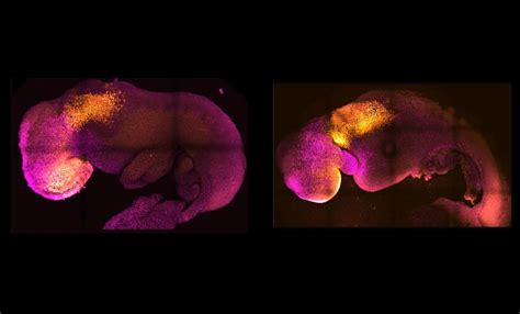 Experimentálne embryo človeka a zvieraťa