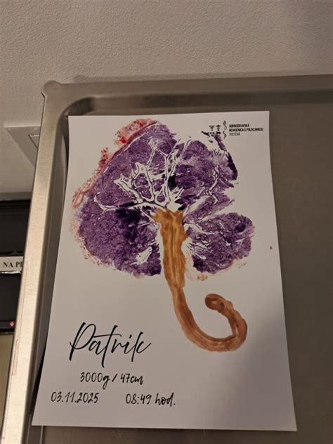 Odtlačok placenty ako strom života