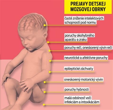 Infografika znázorňujúca možné príčiny detskej mozgovej obrny