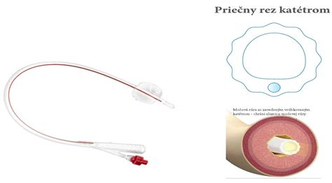 Rôzne typy nádob na sekréty pre odsávačky