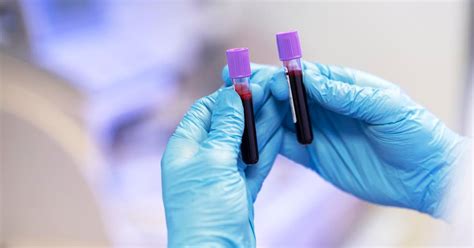 Krvný test na trombofíliu