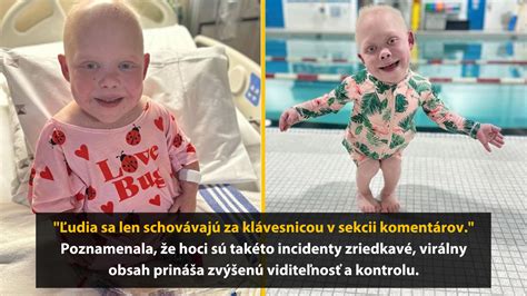 Ilustrácia dieťaťa, ktoré má afektívny záchvat