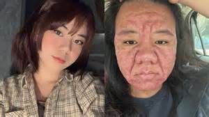 Muž a žena sa objímajú počas tehotenstva