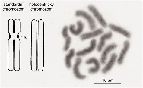 Chromozómy v ľudskej bunke