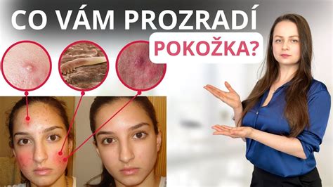 Porovnanie pokožky pred a po použití regeneračného krému