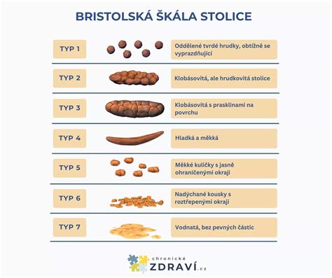 farebná škála stolice
