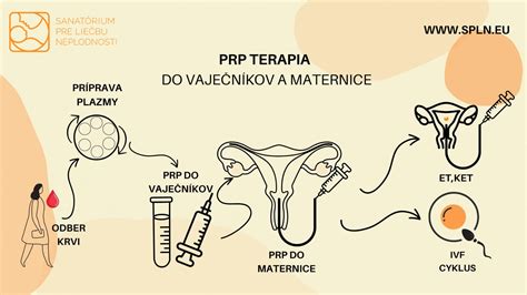odber vajíčok pri IVF