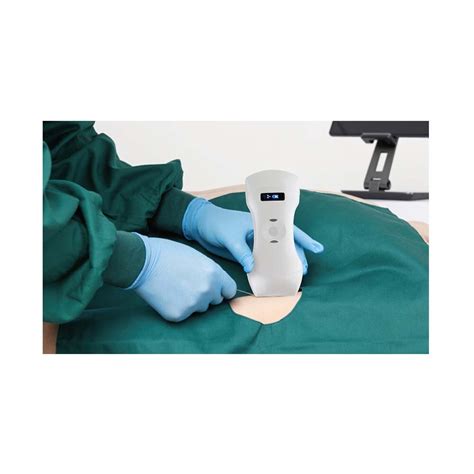 Ultrazvuková sonda a jej pôsobenie na tkanivá