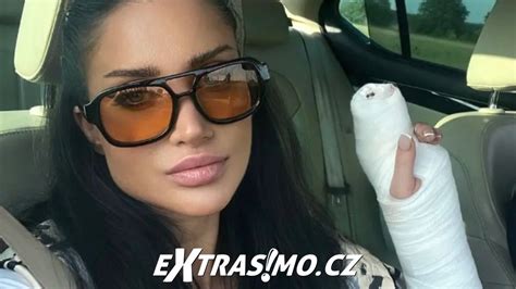 Následky útoku na majiteľku psa