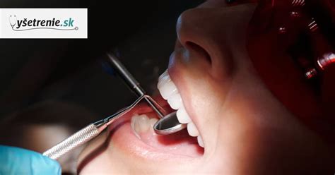 Anatomické znázornenie uzdičiek v ústnej dutine