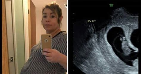 Ultrazvukový snímok maternice