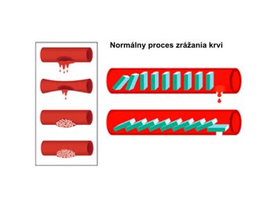 Ilustrácia zrážania krvi