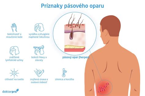 Schéma liečby pásového oparu