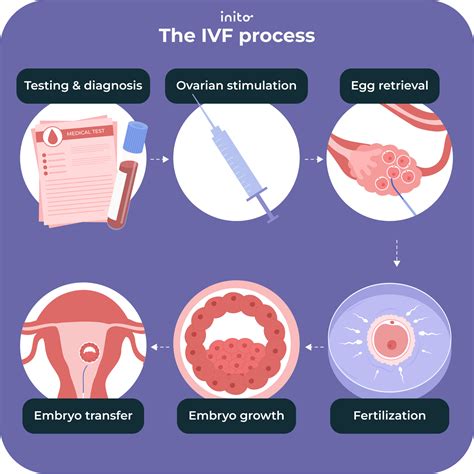 Ilustrácia IVF
