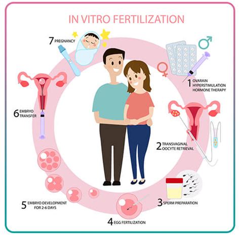 Schéma priebehu IVF cyklu