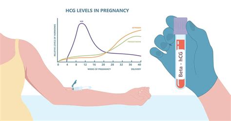 Infografika zobrazujúca hladinu hCG počas tehotenstva