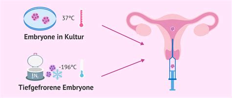 Embryotransfer