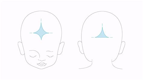 Ilustrácia veľkej a malej fontanely na hlave bábätka