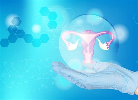 Ilustrácia zavedenia Mireny do maternice