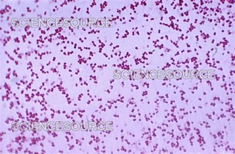 Mikroskopický snímok baktérie Moraxella catarrhalis