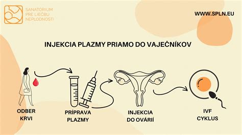 Schéma predoperačných vyšetrení