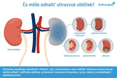 Anatomická schéma obličiek