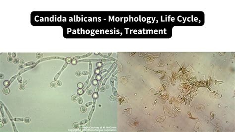 Mikroskopické zobrazenie Candida albicans