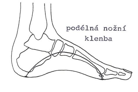 Schéma vývoja klenby detskej nohy