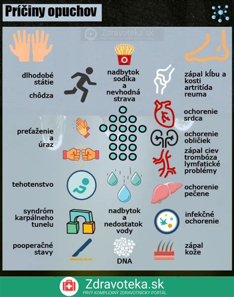 Infografika o príčinách opuchnutých nôh