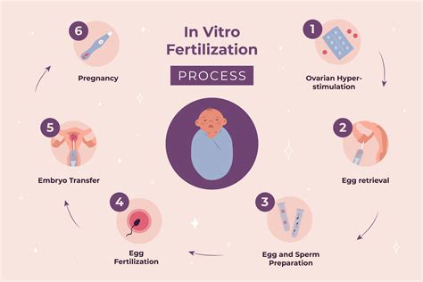 Grafika: Proces IVF
