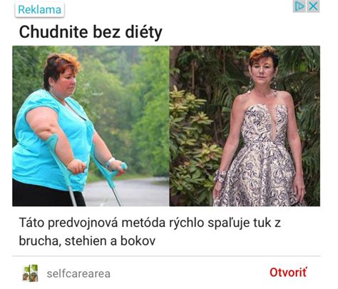 Pred a po chudnutí Kali