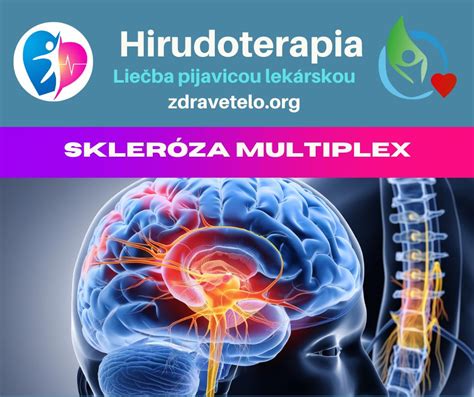 Grafické znázornenie dopamínového systému v mozgu